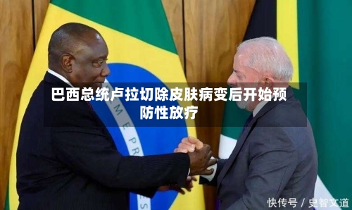 巴西总统卢拉切除皮肤病变后开始预防性放疗